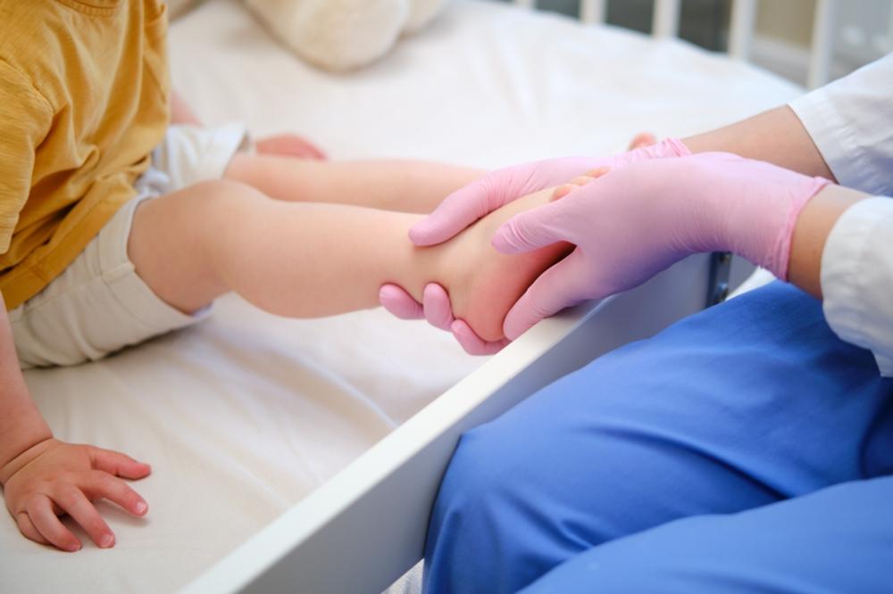 Best Pediatric Orthopedic Doctors In Dubai